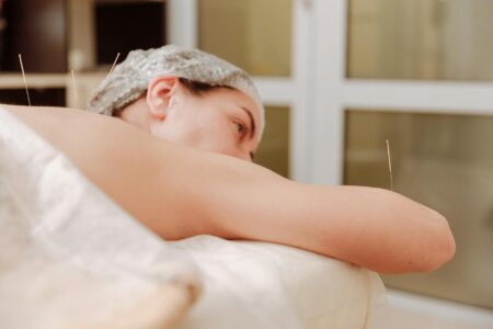 Close-up of acupuncture needles placed on skin during facial treatment