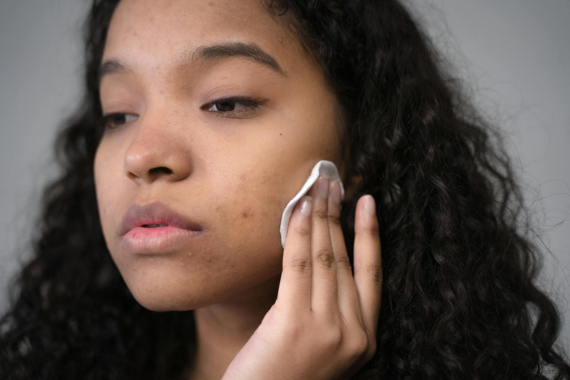 Close-up portrait showing healthy, clear facial skin after treatment